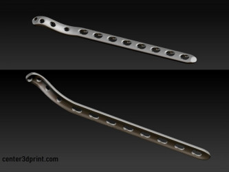 3D-сканування для медицини на замовлення